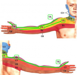 skausmas elbow sustaines gydymas gogress artrozė pėdų gydymas
