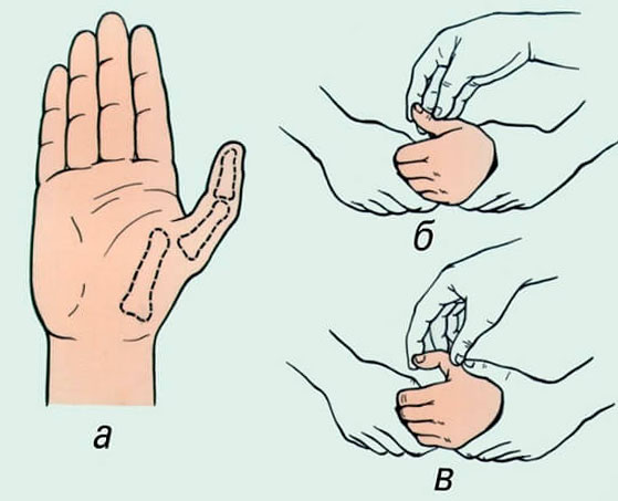 rankų skauda bendroje šepečiu artritas piršto rankos priežastis