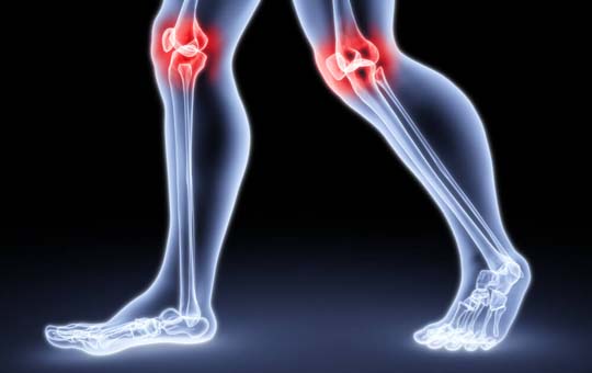 artritas sustav pėdų gydymas