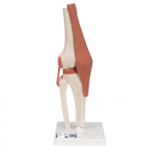 gerklės sąnarių pėdos viršuje priemonės nuo skausmo kaulų ir sąnarių