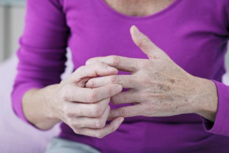 artritas 1 laipsnis peties gydymui