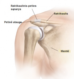 sustaines reumatoidinis artritas