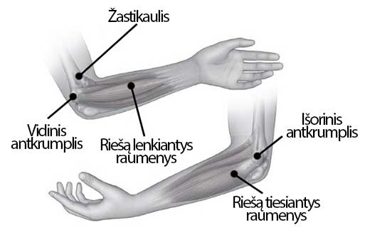 alkūnės sąnario dešinės rankos skausmas skausmas dilbio raumenų ir alkūnės sąnario
