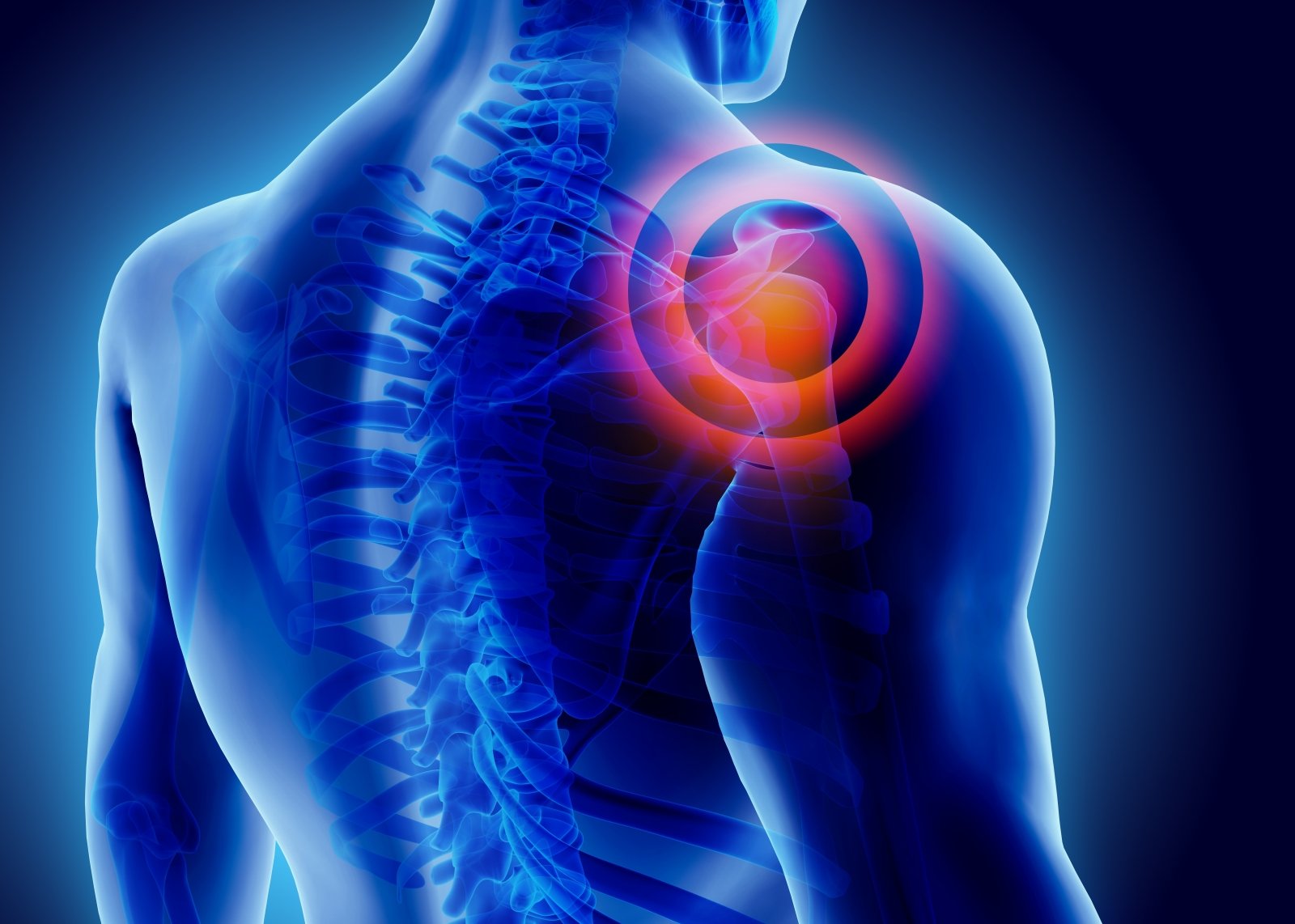 skausmas peties sąnario gydymo nuomonių kaip pašalinti jungtinis artrito sąnario