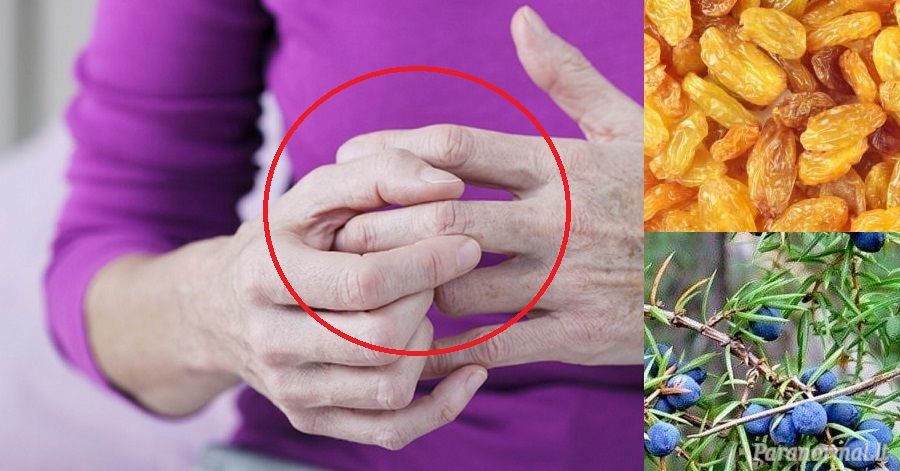 receptai nuo skausmo rankų sąnariuose ūmus artrozė šepečių rankos ir jos gydymas