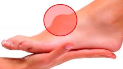 reumatoidinis artritas iš rankų sąnarių