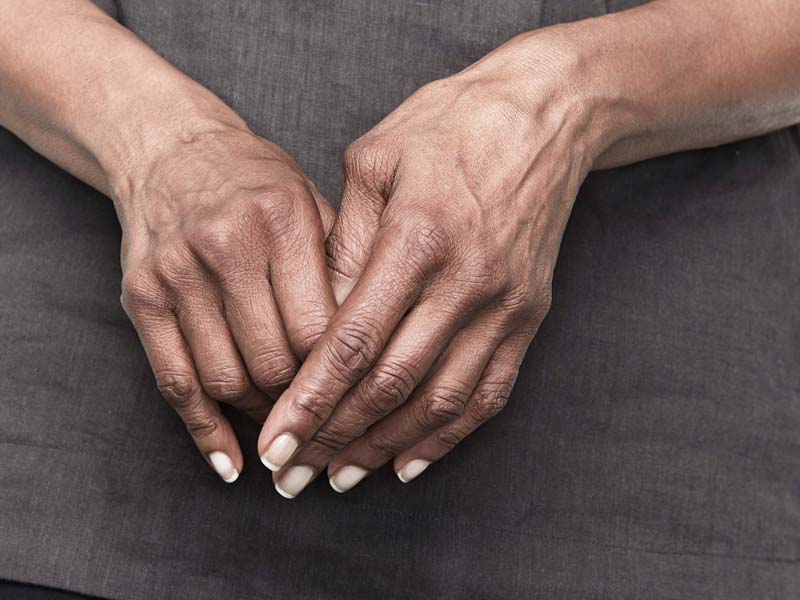 sukelia artritas rankų ką daro peties sąnario raumenys