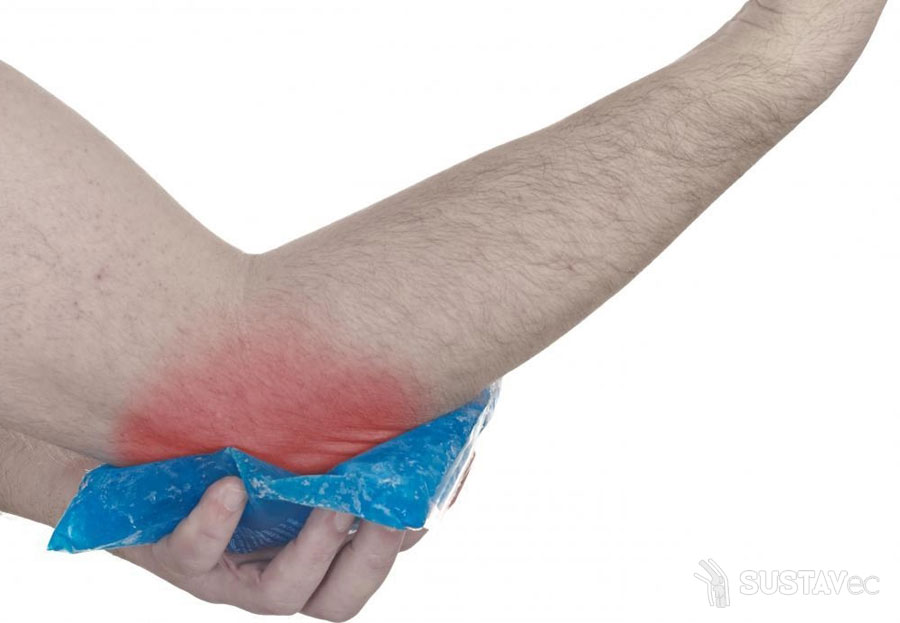 artritas sustav falang rankos skausmas alkūnės sąnario po kritimo