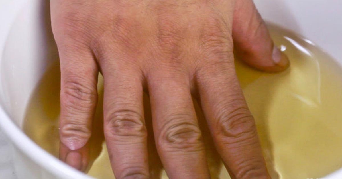 sąnarių rankų ir kaklo artritas piršto priemonės