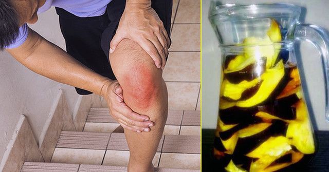 gydymas liaudies gynimo artrosis kojomis