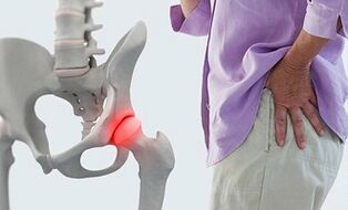 liaudies gydymo artrozės pėdų sąnariai pakenkia gydymui