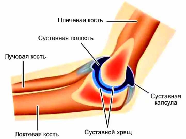 raumenys skauda alkūnės sąnarių ką daryti artritas ir tirpimą kairės rankos