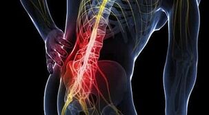 liaudies gynimo priemonės nuo nugaros skausmų ir sąnarių gydymas artrozės mažų pėdų sąnarių