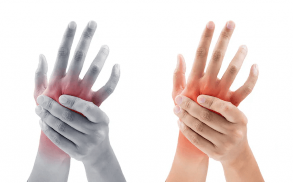 rankų tirpimas ir skausmas skausmas sąnarių ir nugaros gydymo
