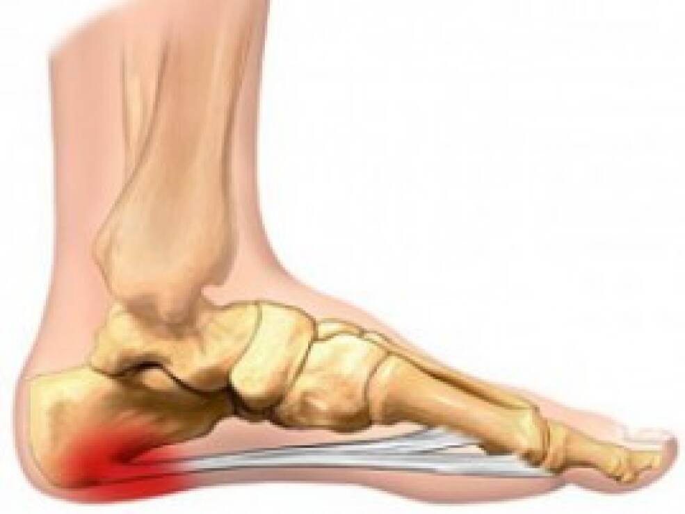 pėdos sąnario ir kulno skausmas rinkinys raumenys skauda
