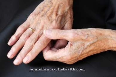 skausmas ir sąnarių viduriniosios pirštu rankų raumenų skausmas