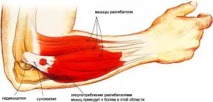 rankų skauda alkūnės sąnario ir dilbio siurbimo nervo peties sąnario gydymas
