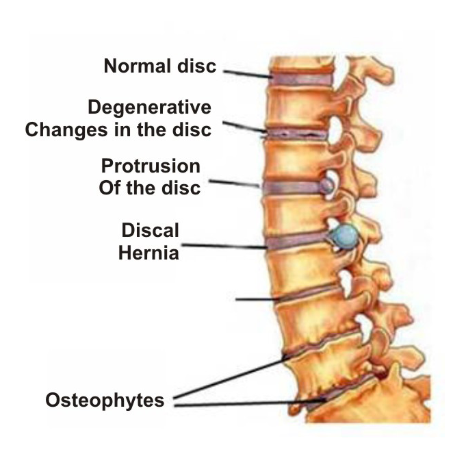 swelling in joints causes gydymas skausmas nugaros ir sąnarių
