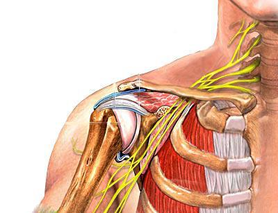 atsižvelgdama skausmą peties sąnario ligos nuo nugaros sąnarių