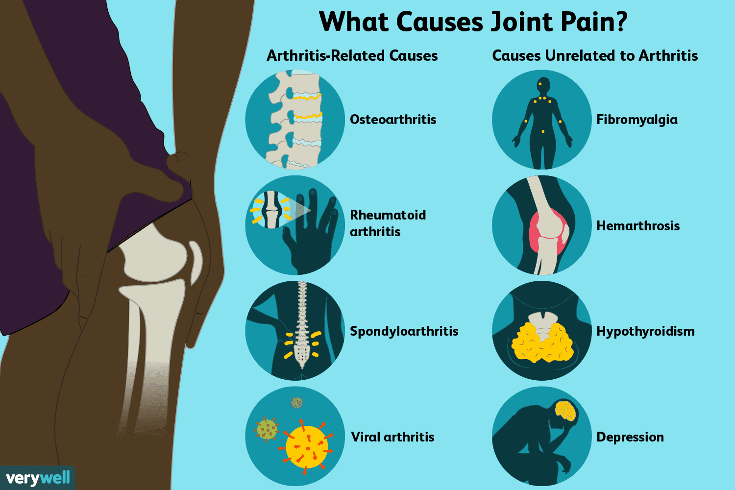 painful swollen warm joints