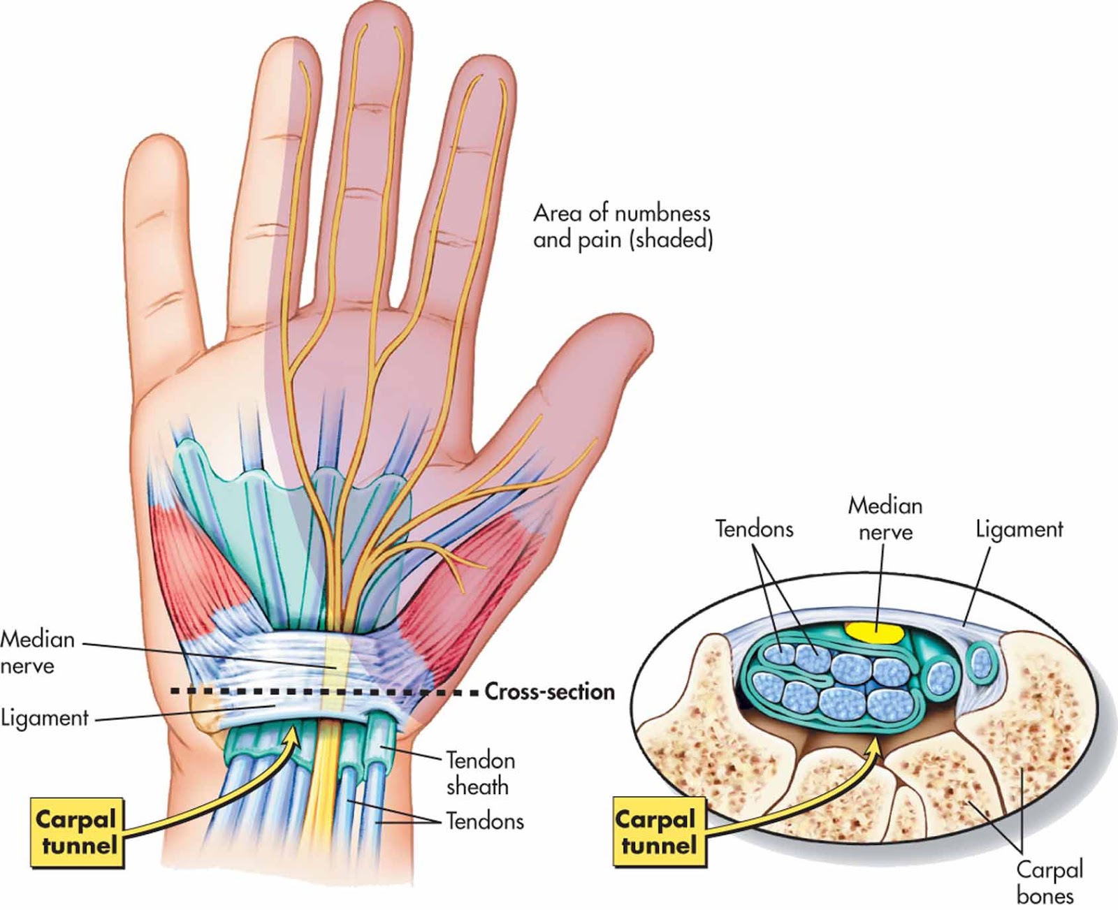 gydymo tepalas gerklės riešo sąnario rankos