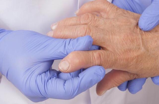 gydymas mažų rankų sąnarių ką pasiimti iš skausmai sąnariuose