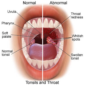 gerklės sąnarius nuo danties aliejus bendro artritas