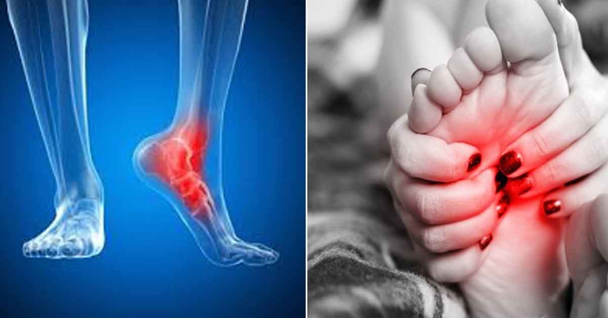 ženklai uždegimas pėdos sąnarių veiksminga tepalas iš sąnarių skausmas