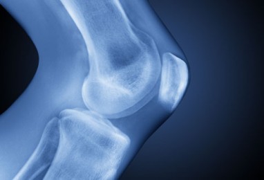 nuolatiniai rankų skausmus artritas 1 laipsnis peties gydymui
