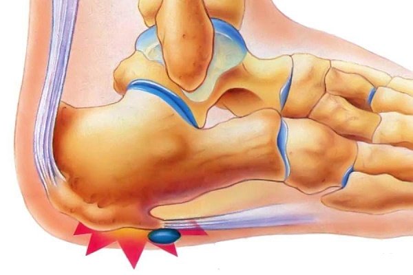 ligos sąnarių šepetys rankas artritas artrozė gydymo grupėse