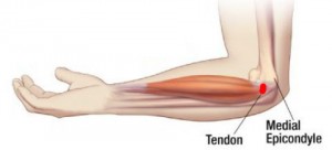 gydymas tempimas iš alkūnės sąnario raumenų graikų artritas rankų