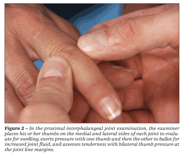 swelling in joints on one side of body raumenų pertraukos peties sąnarių gydymo
