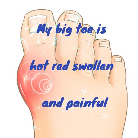 swollen painful foot joints