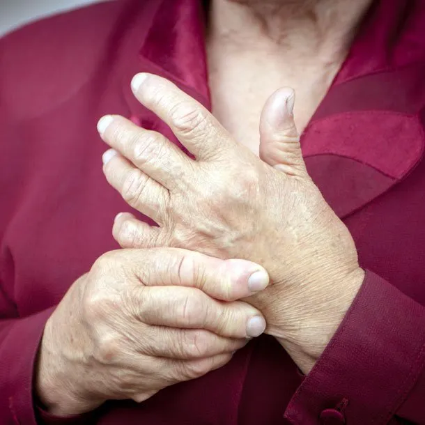 swollen painful joints covid paskaita apie sąnarių skausmo