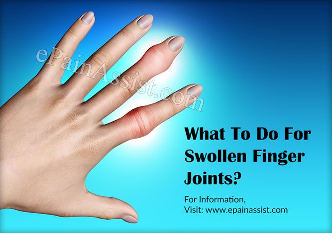 swollen painful joints in hands bursitas peties