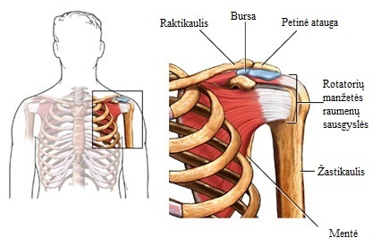 kaklo osteochondrozė 2 stadija