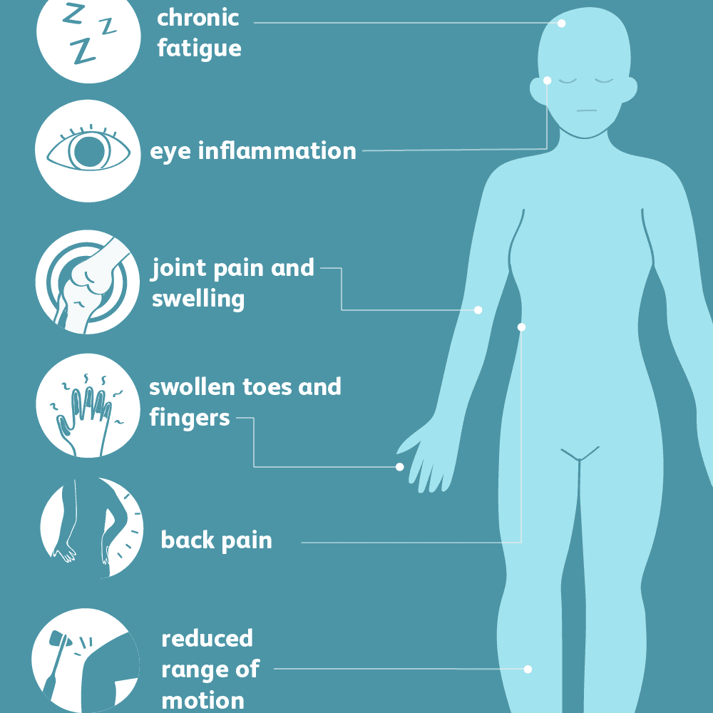 psoriasis artritas simptomai