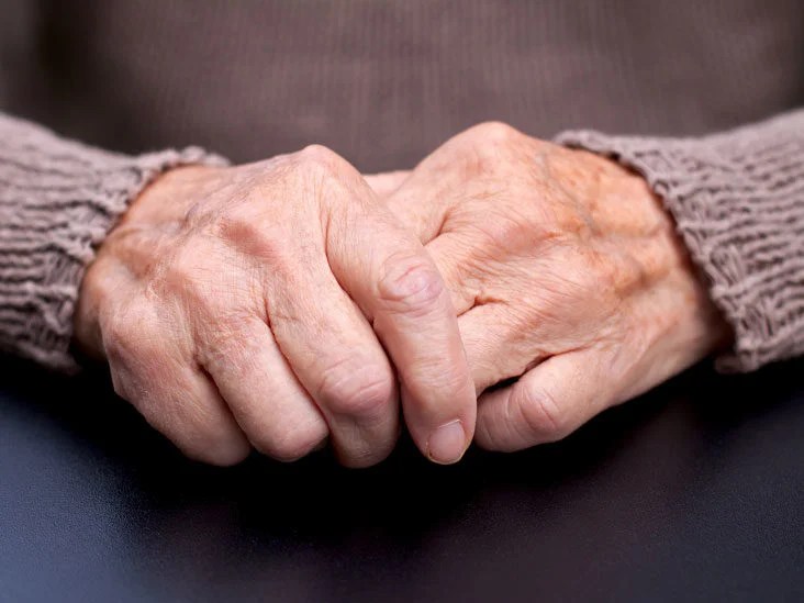 artritas sust liaudies vaistažolės nuo artrozės sąnarių