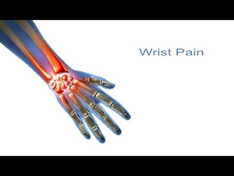 priežastys nykščio skausmo tepalas su artritu alkūnės sąnario