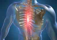 osteochondrozė tepalai neturi įtakos skrandžio palaiko skausmą nuo oro sąlygų