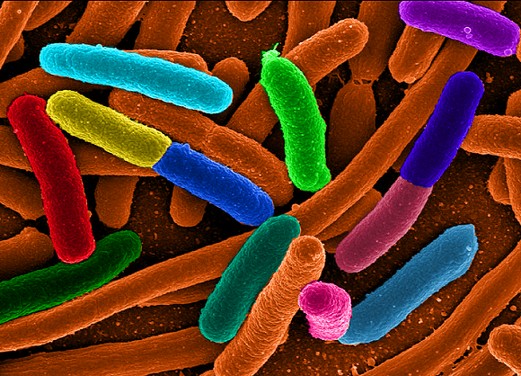 bakterijos sukelia ligas sąnarių