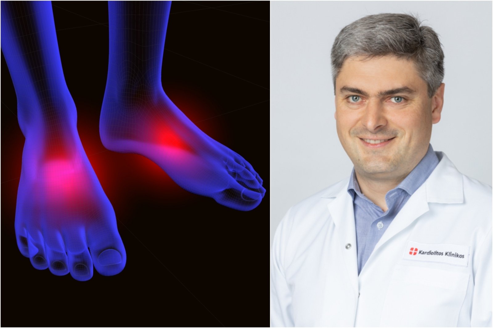 ligos pėdos klasifikavimo sąnarių gydymas skausmai peties sąnario