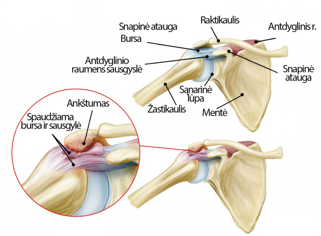 raumenys skauda peties sąnario avokadų į artrozės gydymo